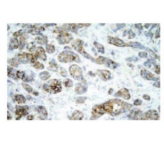 D53 Antibody (d1C5) - Immunohistochemistry - Image 67349