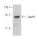 DAAM2 Antibody (E-1) - Western Blotting - Image 364968