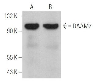 DAAM2 Antibody (E-1) - Western Blotting - Image 369367 