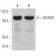 DAAM2 Antibody (E-1) - Western Blotting - Image 369367 