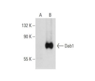 Dab1 (G-5): sc-271136. Western blot analysis of Dab1 expression in non-transfected: sc-117752 (A) and human Dab1 transfect