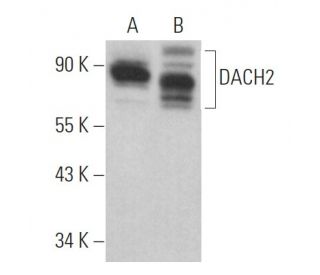 DACH2 Antibody (A-5) - Western Blotting - Image 371992 