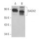 DACH2 Antibody (A-5) - Western Blotting - Image 371992 