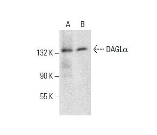 DAGL&alpha; Antibody (E-6) - Western Blotting - Image 287919 
