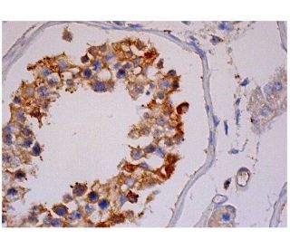 DAP-1 Antibody (C-8) - Immunohistochemistry - Image 284735 