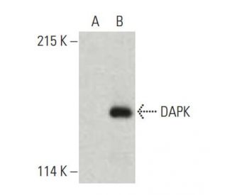 DAPK Antibody (17) - Western Blotting - Image 396369Each CRISPR/Cas9 Knockout (KO) Plasmid product consists of a pool of 3 plasmids designed to ensure identification and cleavage of a specific gene for maximum knockout efficiency. Each plasmid encodes a unique 20 nt sequence derived from the GeCKO (v2) library. 