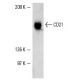 Daudi Cell Lysate: sc-2415. Western blot analysis of CD21 expression...