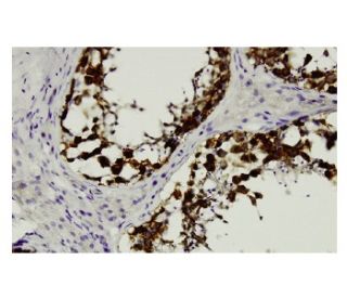 DAZ Antibody (Z6Q) - Immunohistochemistry - Image 36126 