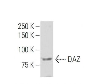 DAZ Antibody (Z6Q) - Western Blotting - Image 34076