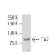DAZ Antibody (Z6Q) - Western Blotting - Image 34076