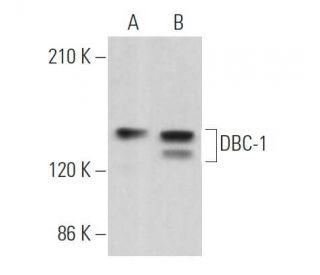 DBC-1 Antibody (H-2) - Western Blotting - Image 363838
