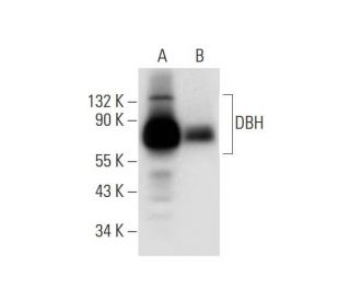 DBH Antibody (A-9) - Western Blotting - Image 295717 