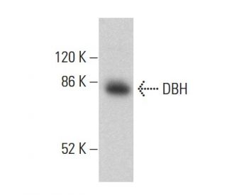 DBH Antibody (A-9) - Western Blotting - Image 360249Each CRISPR/Cas9 Knockout (KO) Plasmid product consists of a pool of 3 plasmids designed to ensure identification and cleavage of a specific gene for maximum knockout efficiency. Each plasmid encodes a unique 20 nt sequence derived from the GeCKO (v2) library.