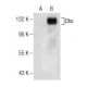 Dbs Antibody (C-7) - Western Blotting - Image 155503 