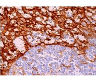DC-SIGN Antibody (DC28) - Immunohistochemistry - Image 383641 