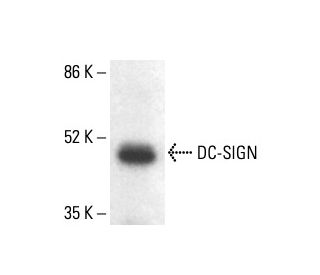 DC-SIGN Antibody (MR-1) - Western Blotting - Image 411203 