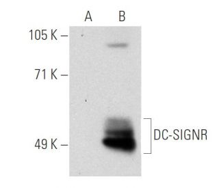 DC-SIGN/DC-SIGNR Antibody (14E3G7) - Western Blotting - Image 34918 