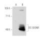 DC-SIGN/DC-SIGNR Antibody (14E3G7) - Western Blotting - Image 34918 