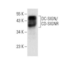 DC-SIGN/DC-SIGNR Antibody (B-2) - Western Blotting - Image 299082 