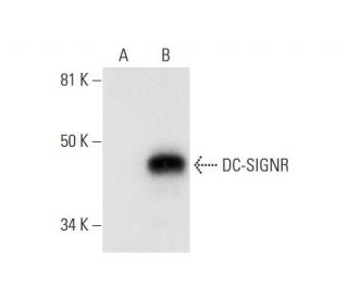 DC-SIGNR Antibody (G-8) - Western Blotting - Image 295851