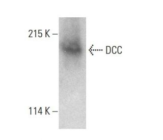DCC Antibody (A-1) - Western Blotting - Image 387989SAM Transcription Activation: SAM system utilizing dCas9-VP64, MS2-P65-HSF1, and sgRNA for precise gene transcription activation. 