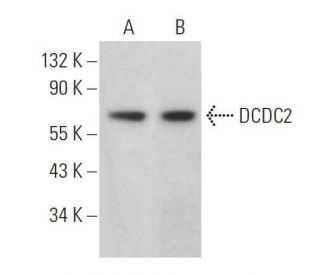 DCDC2 Antibody (E-11) - Western Blotting - Image 359117 