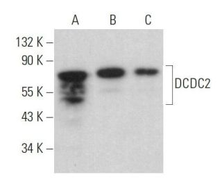 DCDC2 Antibody (E-8) - Western Blotting - Image 359126 