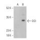 DCI Antibody (E-8) - Western Blotting - Image 401237