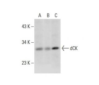 dCK Antibody (2243C2) - Western Blotting - Image 312942 