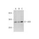 dCK Antibody (2243C2) - Western Blotting - Image 312942 