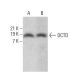 DCTD Antibody (F-9) - Western Blotting - Image 382669