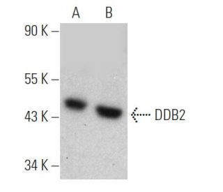 DDB2 Antibody (2246C4a) - Western Blotting - Image 368218Each CRISPR/Cas9 Knockout (KO) Plasmid product consists of a pool of 3 plasmids designed to ensure identification and cleavage of a specific gene for maximum knockout efficiency. Each plasmid encodes a unique 20 nt sequence derived from the GeCKO (v2) library.