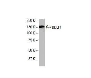 DDEF1 Antibody (P7Q) - Western Blotting - Image 33546 