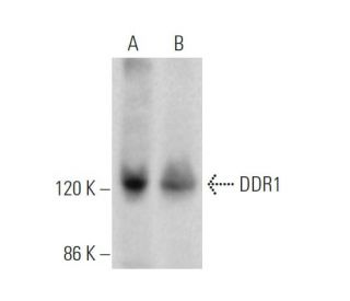 DDR1 Antibody (C-6) - Western Blotting - Image 374716 
