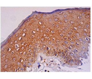 DDR2 Antibody (3B11E4) - Immunohistochemistry - Image 284815 