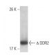 DDR2 Antibody (3B11E4) - Western Blotting - Image 137452