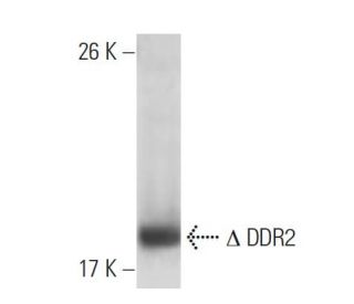 DDR2 Antibody (3B11E4) - Western Blotting - Image 137452Each CRISPR/Cas9 Knockout (KO) Plasmid product consists of a pool of 3 plasmids designed to ensure identification and cleavage of a specific gene for maximum knockout efficiency. Each plasmid encodes a unique 20 nt sequence derived from the GeCKO (v2) library.