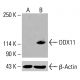 DDX11 抗体 (C-10):sc-515166。通过蛋白质印迹分析未处理(A)和化学处理(B)的HeLa完整细胞裂解物中DDX11的表达。β-肌动蛋白(C4):sc-47778用作加载对照。使用的检测试剂:m-IgG Fc BP-HRP:sc-525409。 DDX11 Antibody (C-10) - Western Blotting - Image 415878