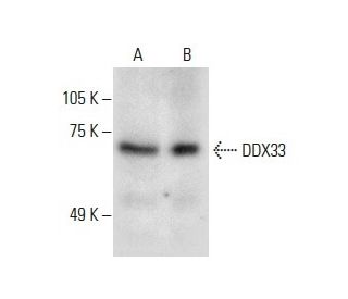 DDX33 Antibody (F-5) - Western Blotting - Image 288510 