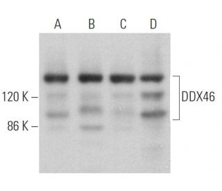 DDX46 Antibody (B-6) - Western Blotting - Image 367115 