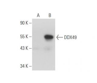 DDX49 Antibody (C-11) - Western Blotting - Image 333577 