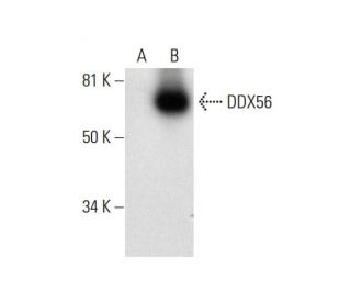 DDX56 Antibody (F-3) - Western Blotting - Image 292024