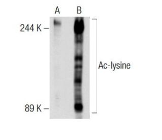 Ac-lysine (AKL5C1): sc-32268. Western blot analysis of lysine acetylation in untreated (A) and deacetylase inhibitor cockt 