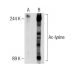 Ac-lysine (AKL5C1): sc-32268. Western blot analysis of lysine acetylation in untreated (A) and deacetylase inhibitor cockt 