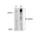 Ac-lysine (7F8): sc-81623. Western blot analysis of lysine acetylation in untreated (A) and deacetylase inhibitor cocktail 