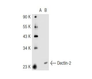 Dectin-2 Antibody (Z-17) - Western Blotting - Image 44894