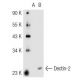 Dectin-2 Antibody (Z-17) - Western Blotting - Image 44894
