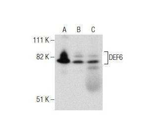 DEF6 Antibody (SW-9) - Western Blotting - Image 160387Each CRISPR/Cas9 Knockout (KO) Plasmid product consists of a pool of 3 plasmids designed to ensure identification and cleavage of a specific gene for maximum knockout efficiency. Each plasmid encodes a unique 20 nt sequence derived from the GeCKO (v2) library.