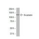 δ-catenin Antibody (40.1) - Western Blotting - Image 33443 