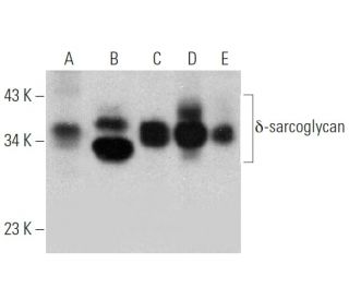 &delta;-sarcoglycan Antibody (B-5) - Western Blotting - Image 363247 